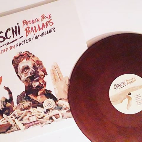 "This Won't Last Forever" is the latest video from Ceschi & Factor Chandelier for their album Broken Bone Ballads .